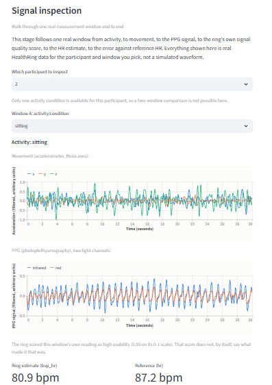 Wearables Signal Inspection